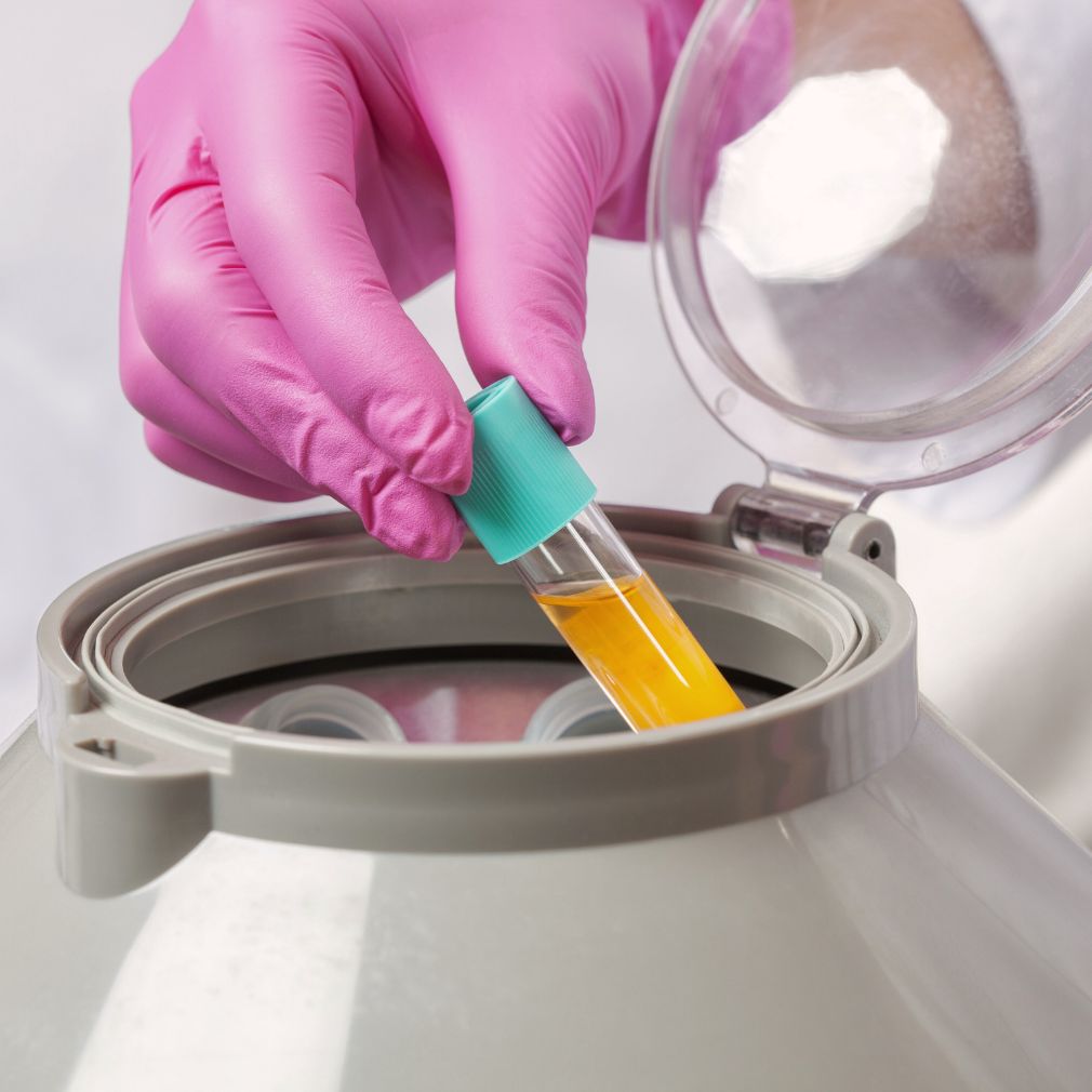 PRP-Eigenbluttherapie