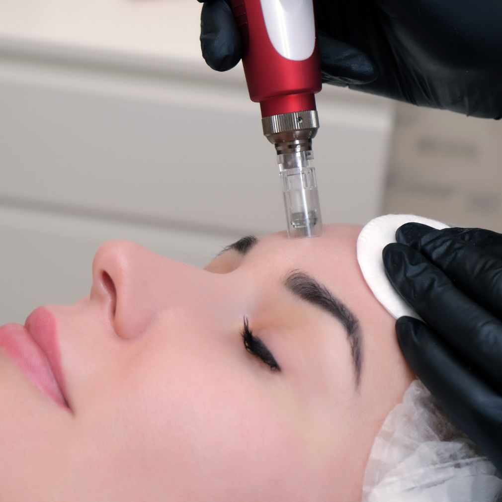 Mesotherapie / Revitalisierung / Lipolyse